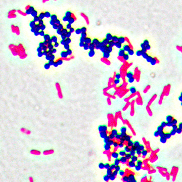 Staphylococcus aureus (Kokken, grampositiv, dunkelviolett) und Escherichia coli (Stäbchen, gramnegativ, rot)