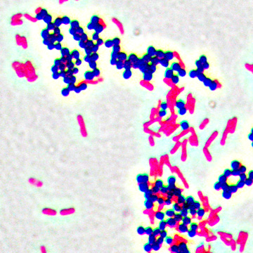 Farbliche Differenzierung von grampositiven bzw. gramnegativen Bakterien unter dem Mikroskop: Staphylococcus aureus (Kokken, grampositiv, dunkelviolett) und Escherichia coli (Stäbchen, gramnegativ, rot) Staphylococcus aureus (Kokken, grampositiv, dunkelviolett) und Escherichia coli (Stäbchen, gramnegativ, rot)